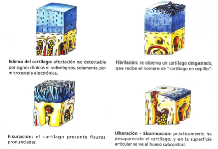 Fases de la lesión del cartílago articular